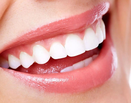 Why-Teeth-Whitening-is-Important-The-Key-to-a-Confident-Smile Biha Dental Care